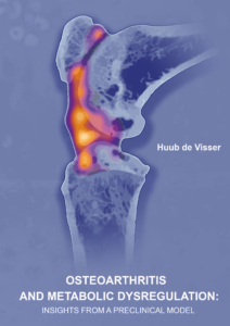 Osteoarthritis and metabolic dysregulation