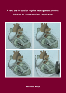 A new era for cardiac rhythm management devices: Solutions for transvenous lead complications