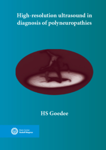 High-resolution ultrasound in diagnosis of polyneuropathies