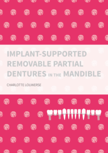 Implant-supported removable partial dentures in the mandible