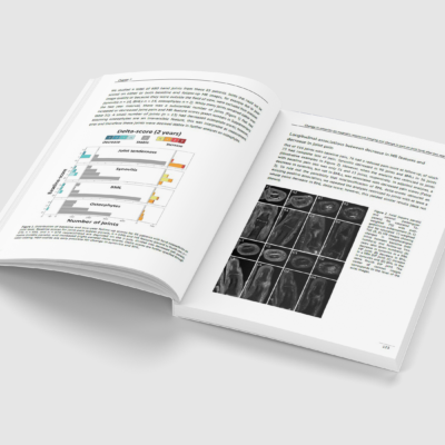 Lessons learnt about two-year follow-up in hand osteoarthritis