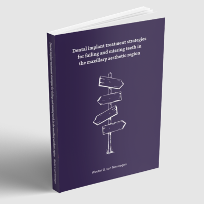 Dental implant treatment strategies for failing and missing teeth in the maxillary aesthetic region