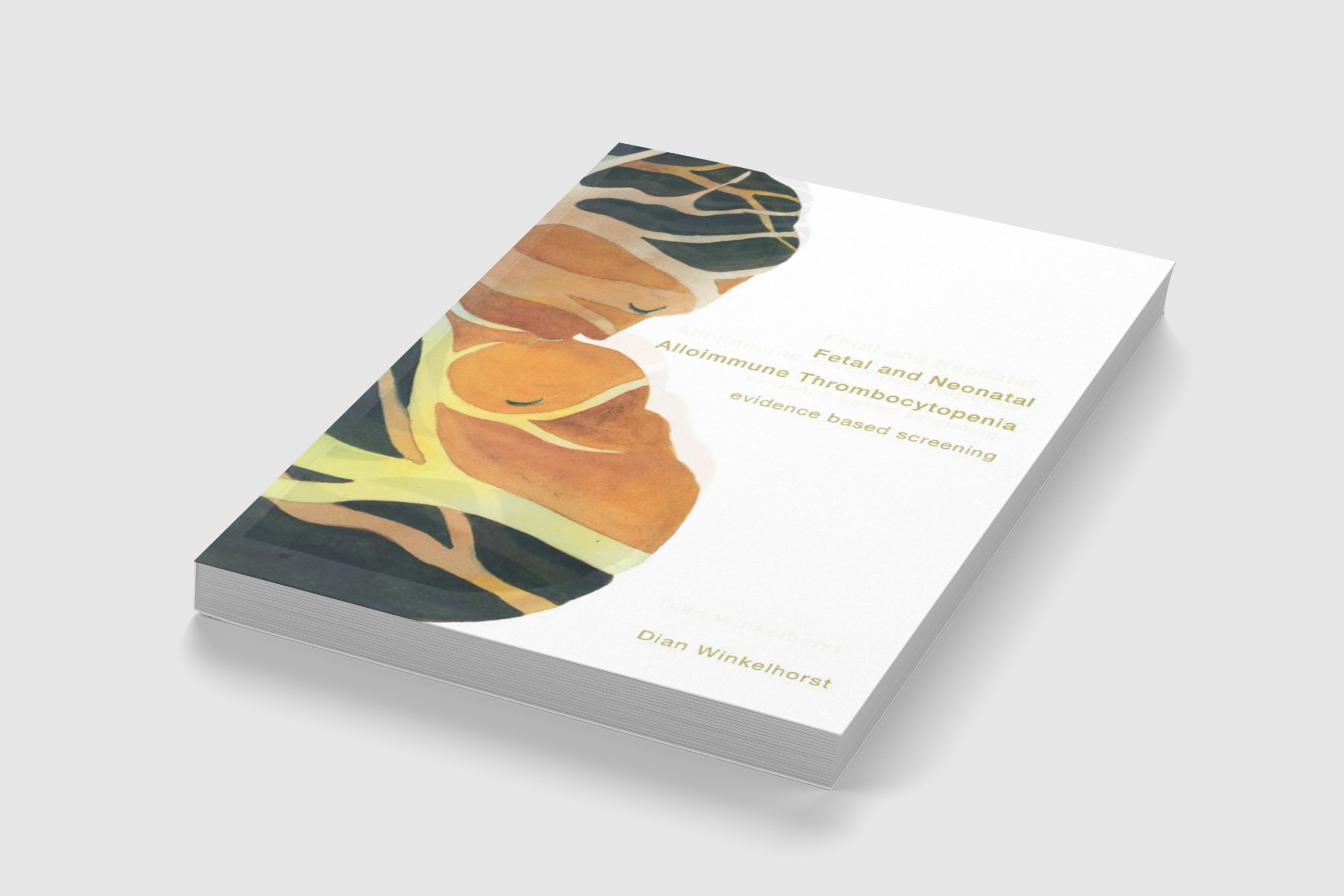 Fetal and Neonatal Alloimmune Thrombocytopenia