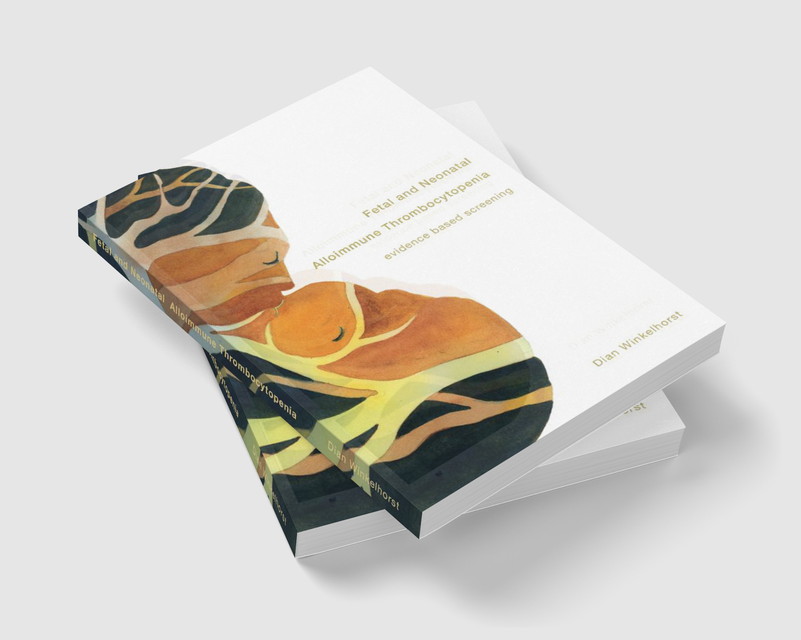 Fetal and Neonatal Alloimmune Thrombocytopenia