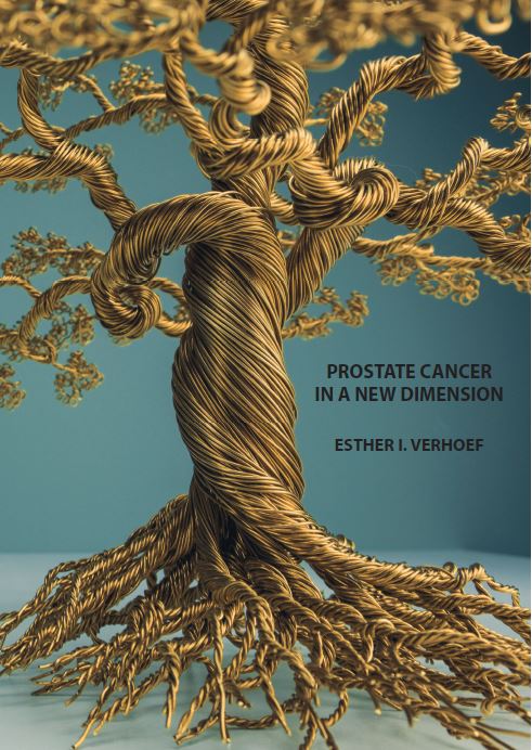 Prostate cancer in a new dimension