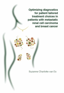 Optimizing diagnostics for patient tailored treatment choices in patients with metastatic renal cell carcinoma and breast cancer