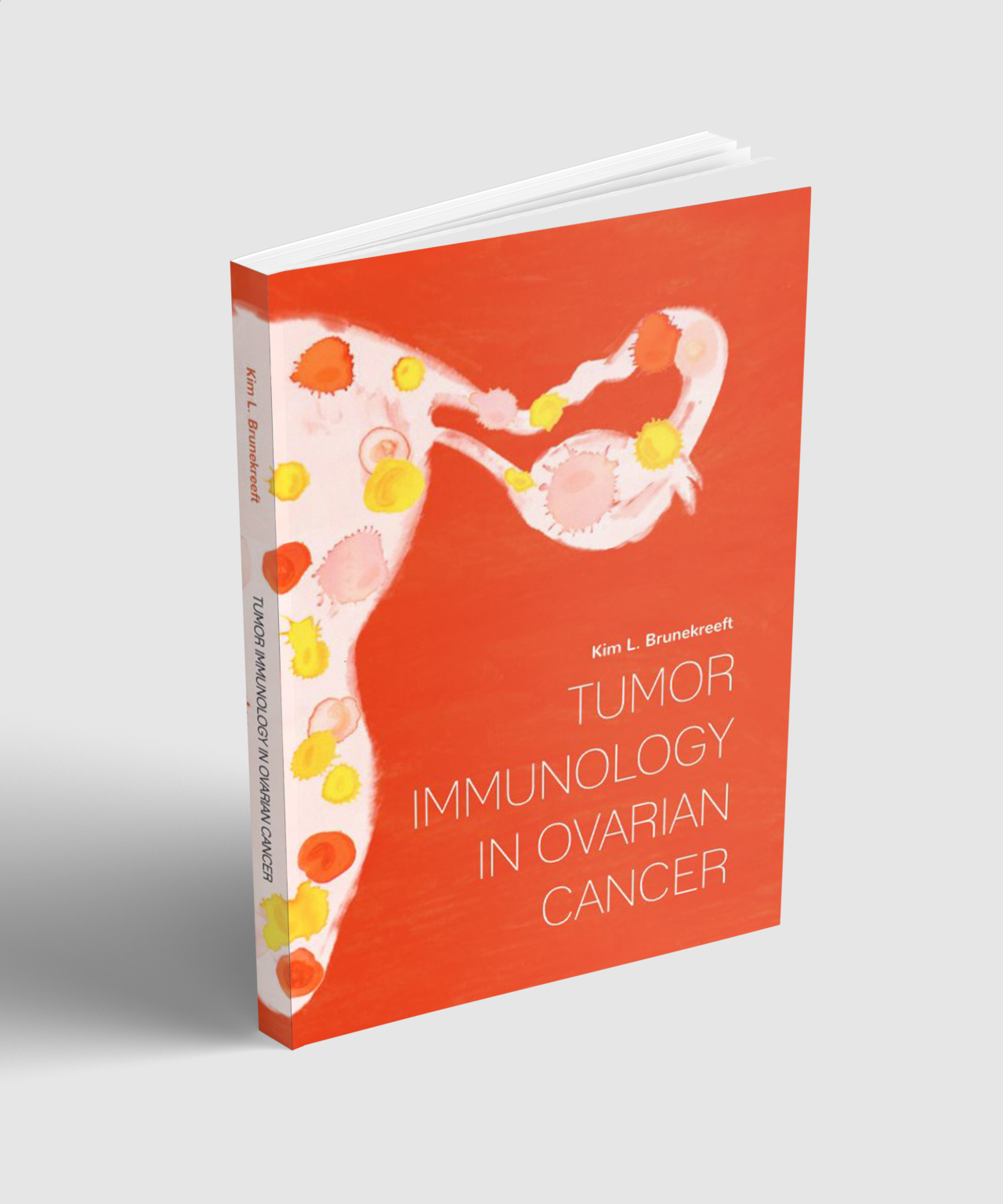 Gildeprint thesis picture