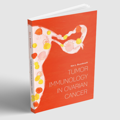 Tumor Immunology in Ovarian Cancer