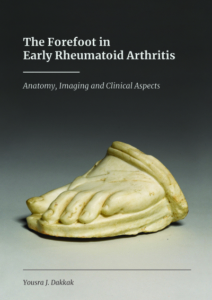 The Forefoot in Early Rheumatoid Arthritis