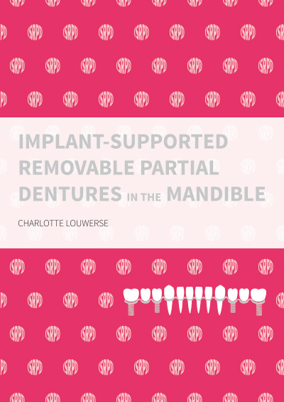 Implant-supported removable partial dentures in the mandible