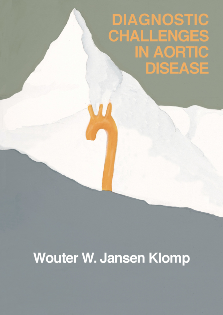 Diagnostic challenges in aortic disease