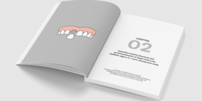 Dental implant treatment strategies for failing and missing teeth in the maxillary aesthetic region