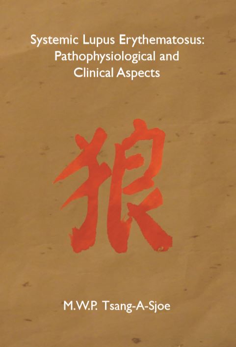 Systemic lupus erythematosus