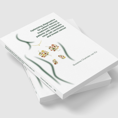 Optimizing diagnostics for patient tailored treatment choices in patients with metastatic renal cell carcinoma and breast cancer