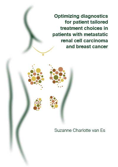 Optimizing diagnostics for patient tailored treatment choices in patients with metastatic renal cell carcinoma and breast cancer