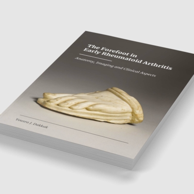The Forefoot in Early Rheumatoid Arthritis