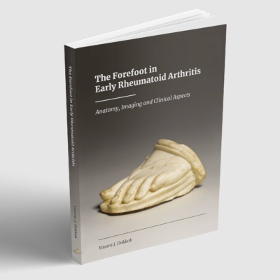 The Forefoot in Early Rheumatoid Arthritis