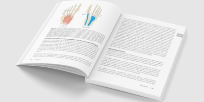 The Forefoot in Early Rheumatoid Arthritis