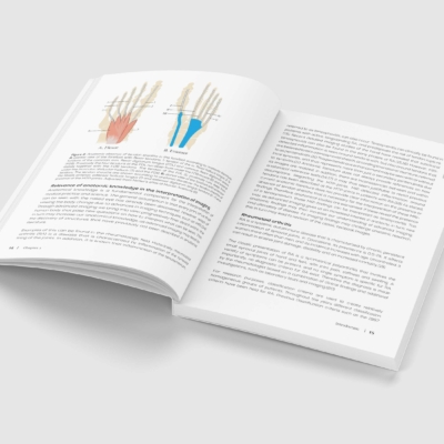 The Forefoot in Early Rheumatoid Arthritis